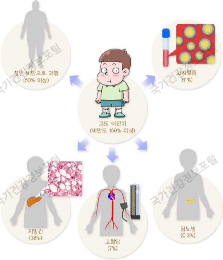 소아비만 그래픽