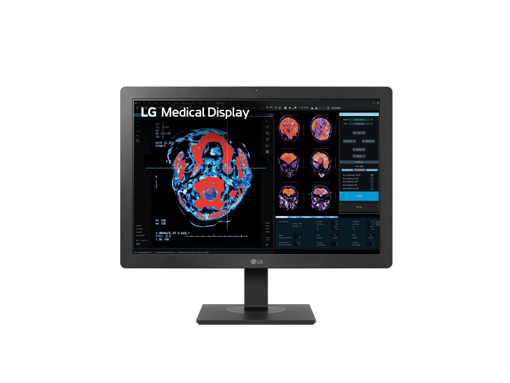 [사진1] 임상에서 진단까지 가능한 LG전자 의료용 모니터 출시