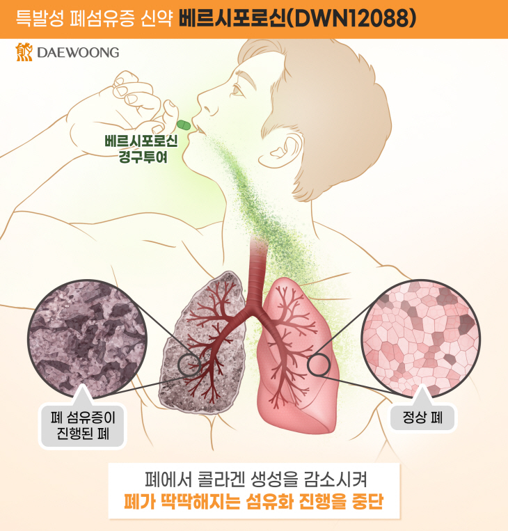 대웅제약