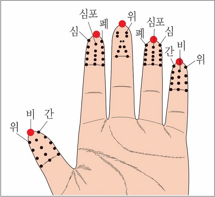 당뇨 채혈 위치도