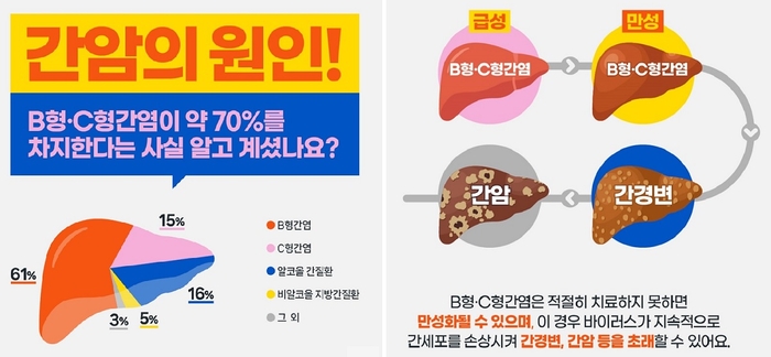 간암의 원인과 간염에서 간암으로 전개도.