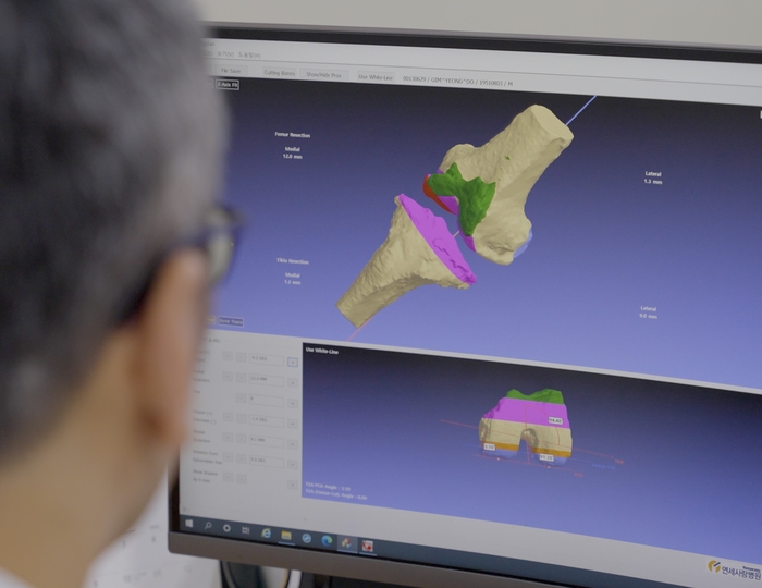 연세사랑병원 연구진이 MRI 무릎 관절 영상을 분석하고 있다. 사진=연세사랑병원