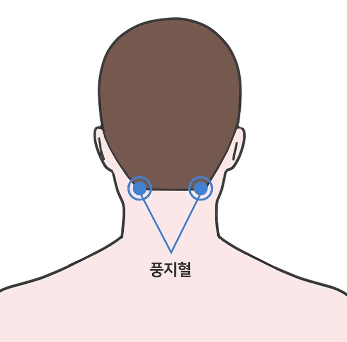 풍지혈