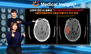 SK C&C, 뇌경색 진단 AI 솔루션 식약처 허가 획득